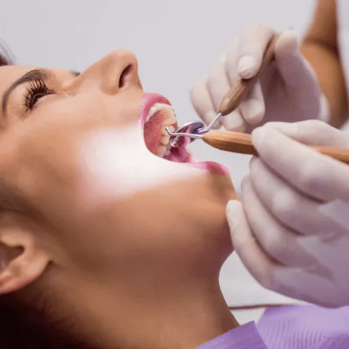 Gloved hands using dental tools in woman's mouth.