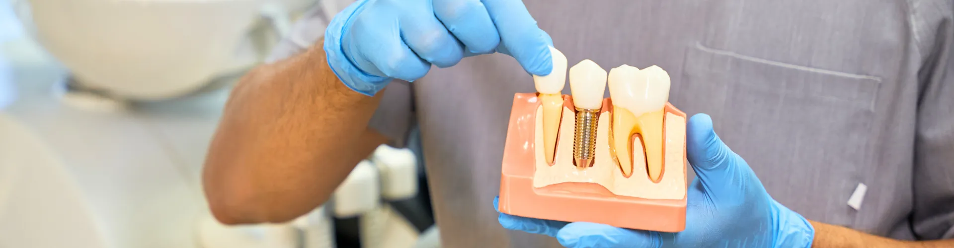Man holding model of dental implant in gloved hands.