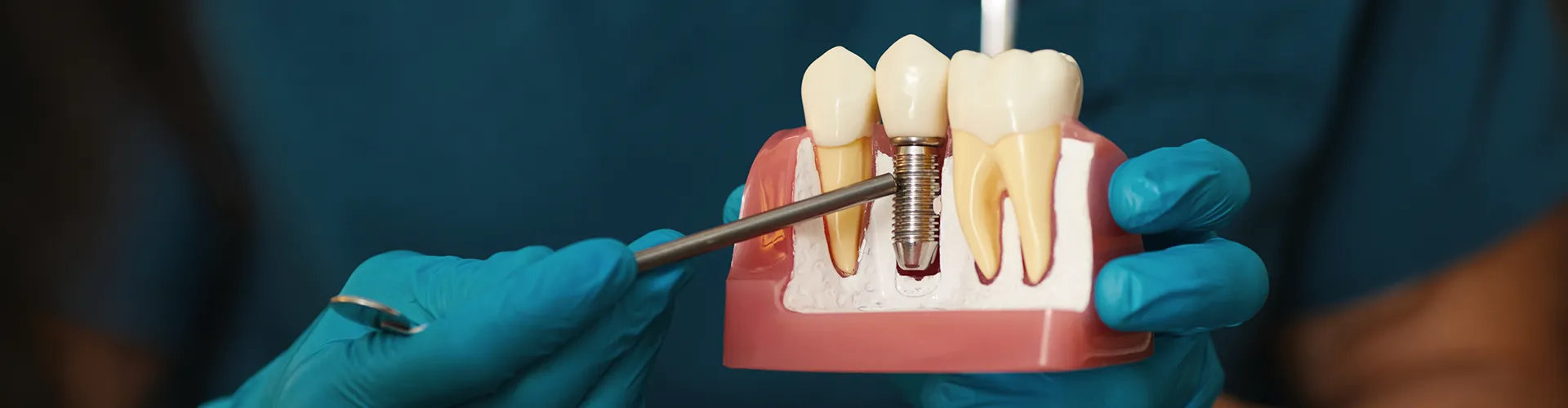 gloved hands holding implant model