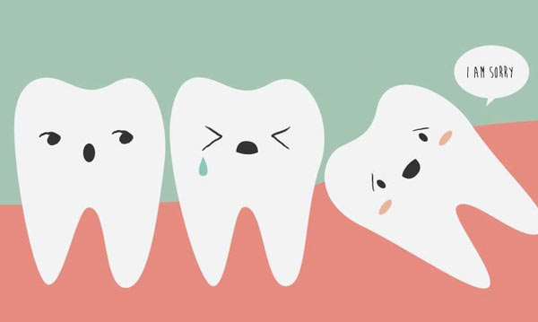 When is it time to pull your Wisdom Teeth?