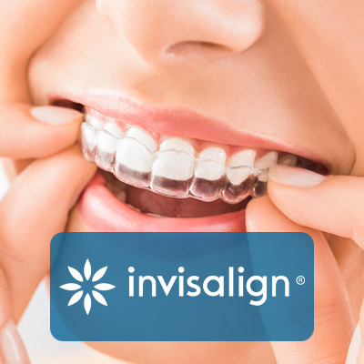 Specials – Invisalign® – $200 OFF with Same Day Orthodontics Treatment