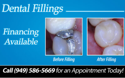 The Benefits of changing your fillings